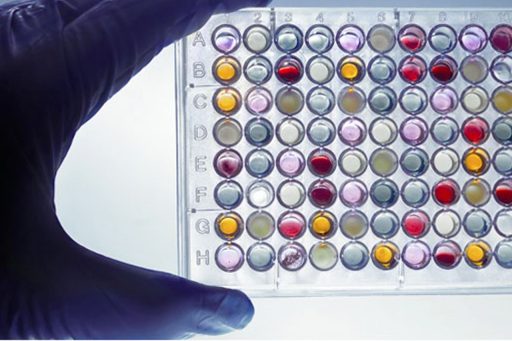 Theradiag Lisa Tracker: Monitorização de Medicamentos Biológicos